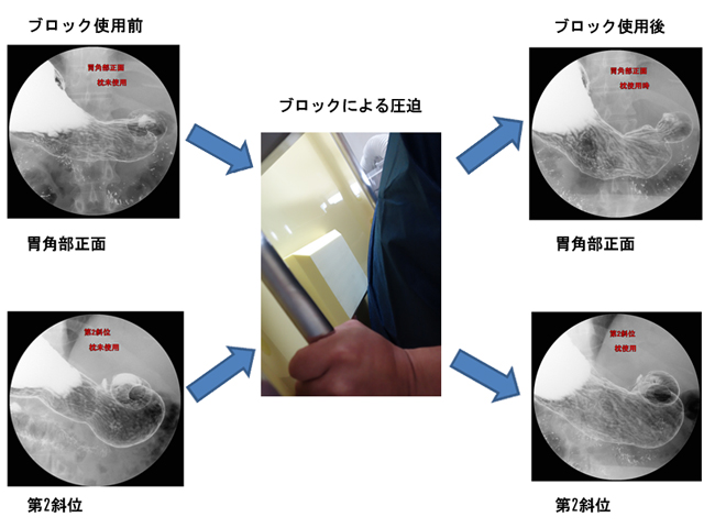 ブロックの使用例